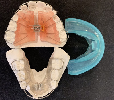 小児矯正の矯正器具