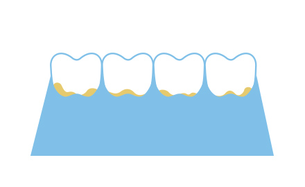 歯と歯ぐきの間のイメージ