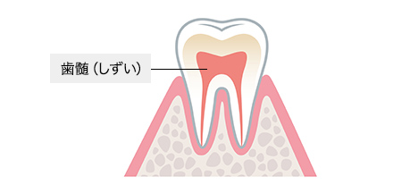 歯髄イメージ